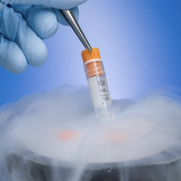inseminacion artificial