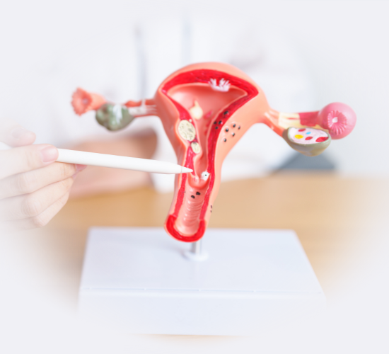 endometrio