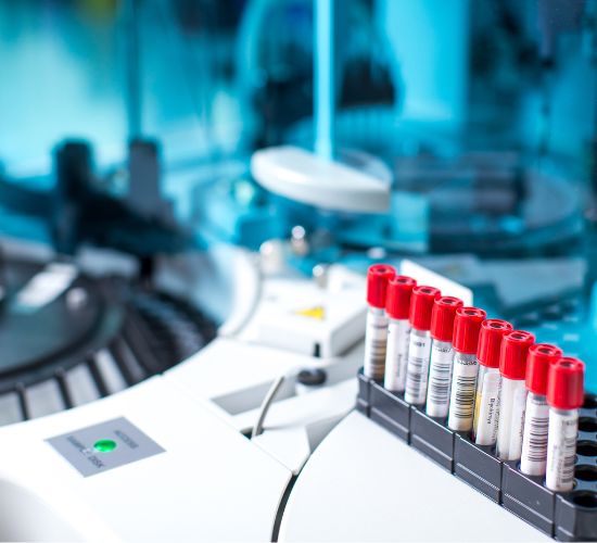 analisis de sangre vida