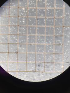 Abstinencia sexual y calidad del semen. La imagen corresponde a la concentración y movilidad espermática. Usamos las cuadrículas para poder contar los espermatozoides 